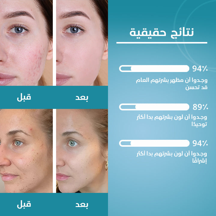 ضمادات الكركم وحمض الكوجيك