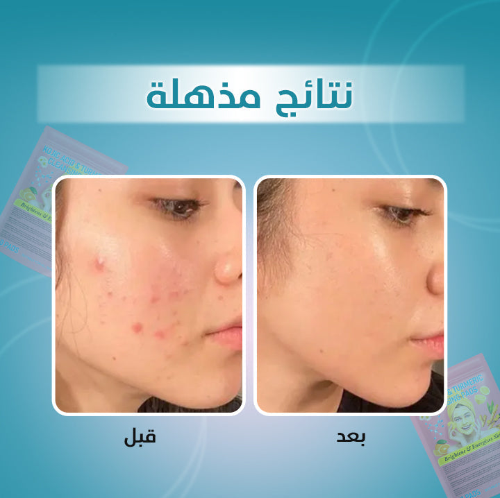 ضمادات الكركم وحمض الكوجيك