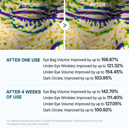 كريم دكتور ميلاكسين لعلاج أكياس العين