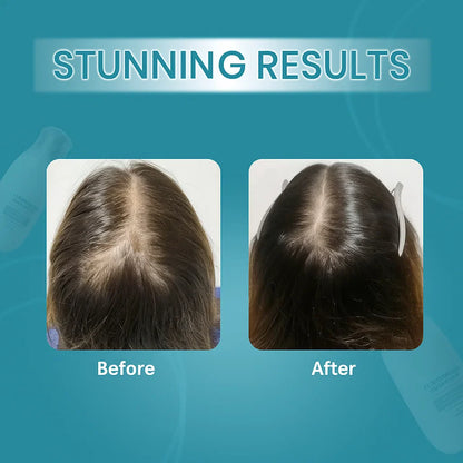 زيفتا إتش - ريجرو 2.0